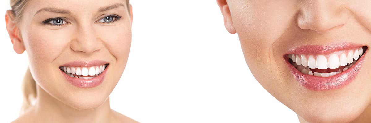 Oro Valley Cosmetic Dental Care