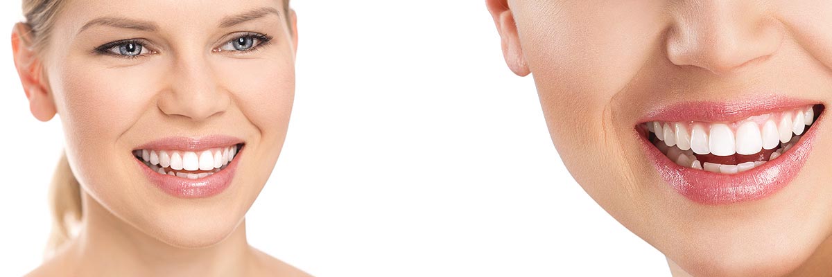 Oro Valley Cosmetic Dental Services