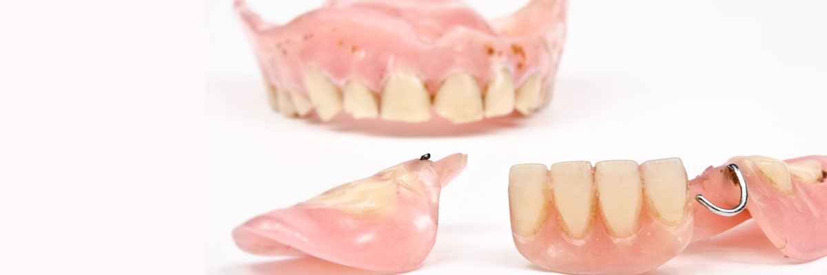 Oro Valley What Do I Do If I Damage My Dentures?