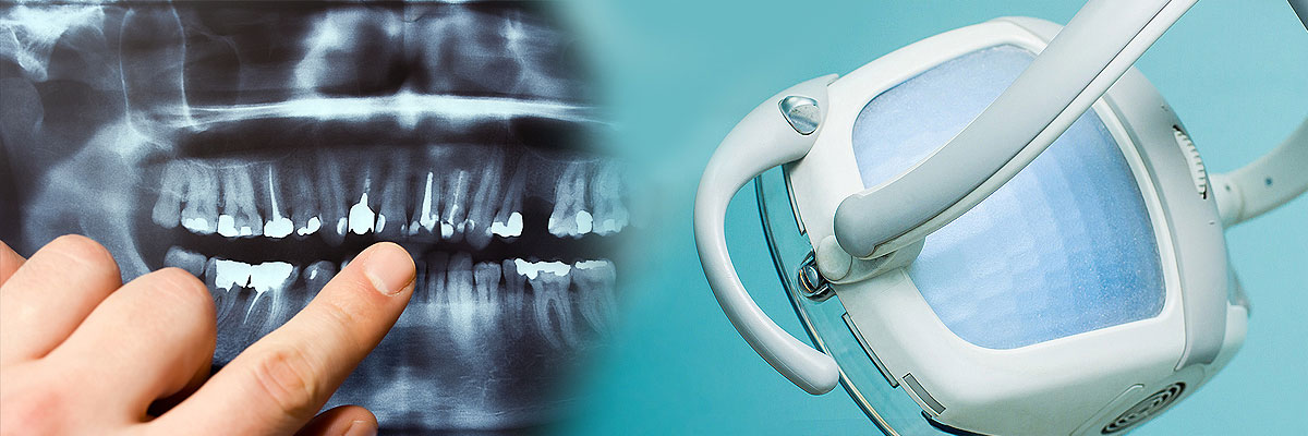 Oro Valley Dental Cleaning