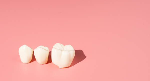 What Is A Dental Crown And When Do You Need One?