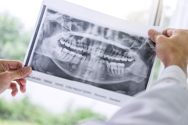 Dental Implant Restorations Oro Valley, AZ