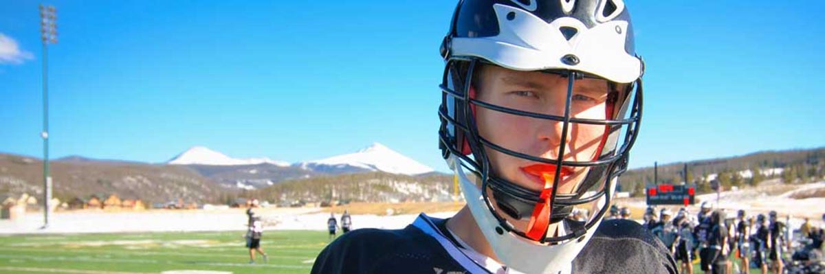 Oro Valley Mouth Guards