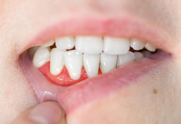 How Periodontics Can Help Take Care Of Your Gums