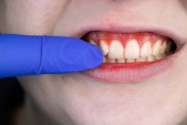 Periodontics: Treatments For Gum Disease