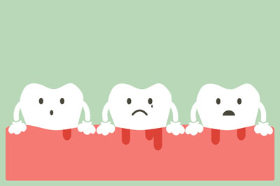 Periodontics And Gum Disease Prevention