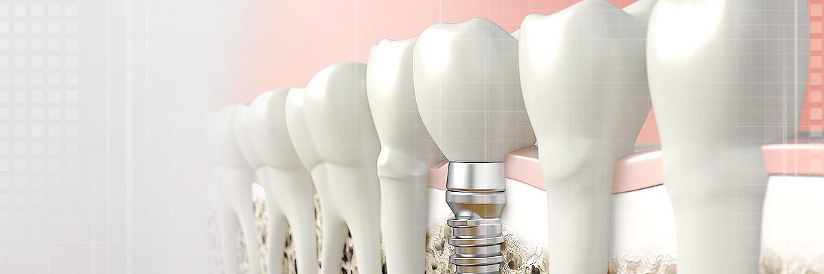 Oro Valley Oral Prosthetics Doctor