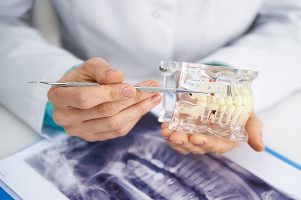 What Happens During The Wisdom Teeth Removal Process?