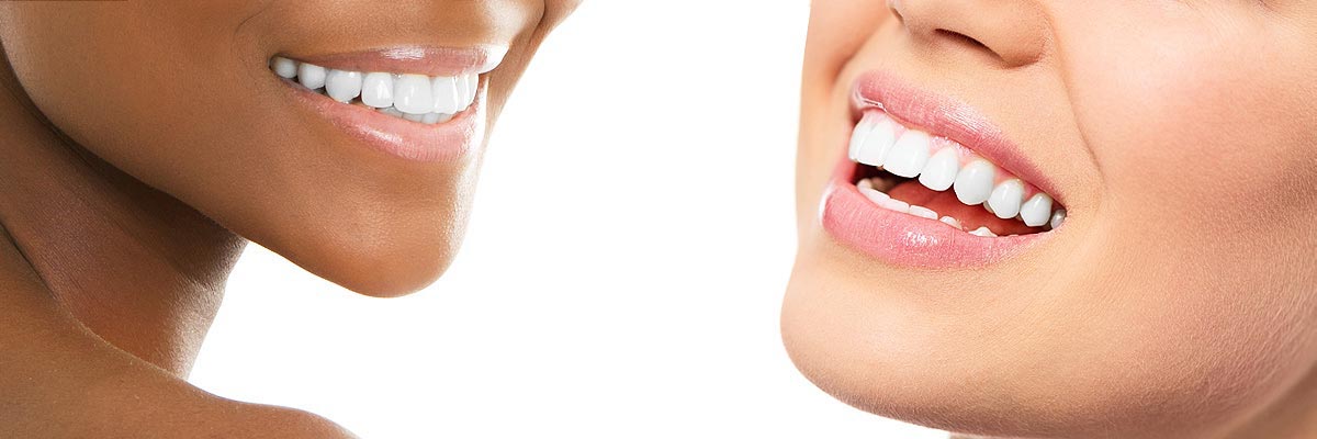 Oro Valley Teeth Whitening