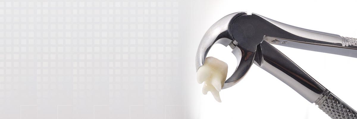 Oro Valley Tooth Extraction