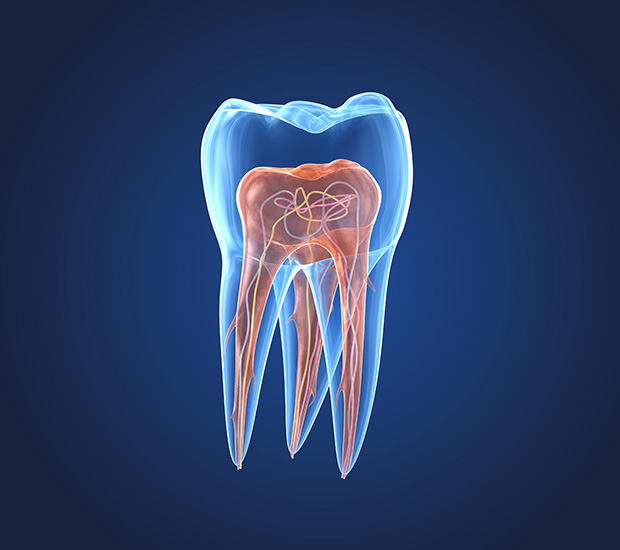 Oro Valley What is an Endodontist