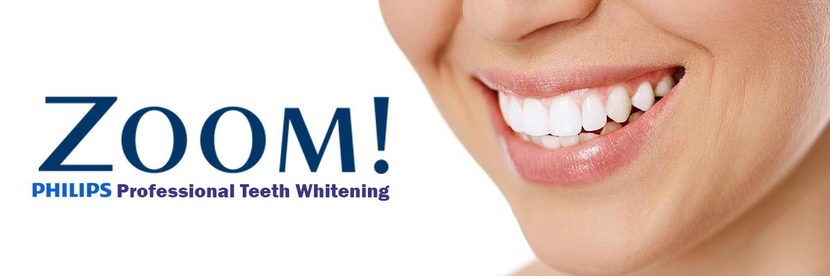 Oro Valley Zoom Teeth Whitening